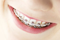 きれいな歯並び