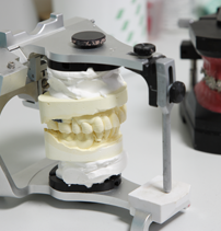 矯正装置について