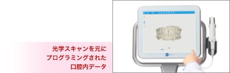 光学スキャンを元にプログラミングされた口腔内データ