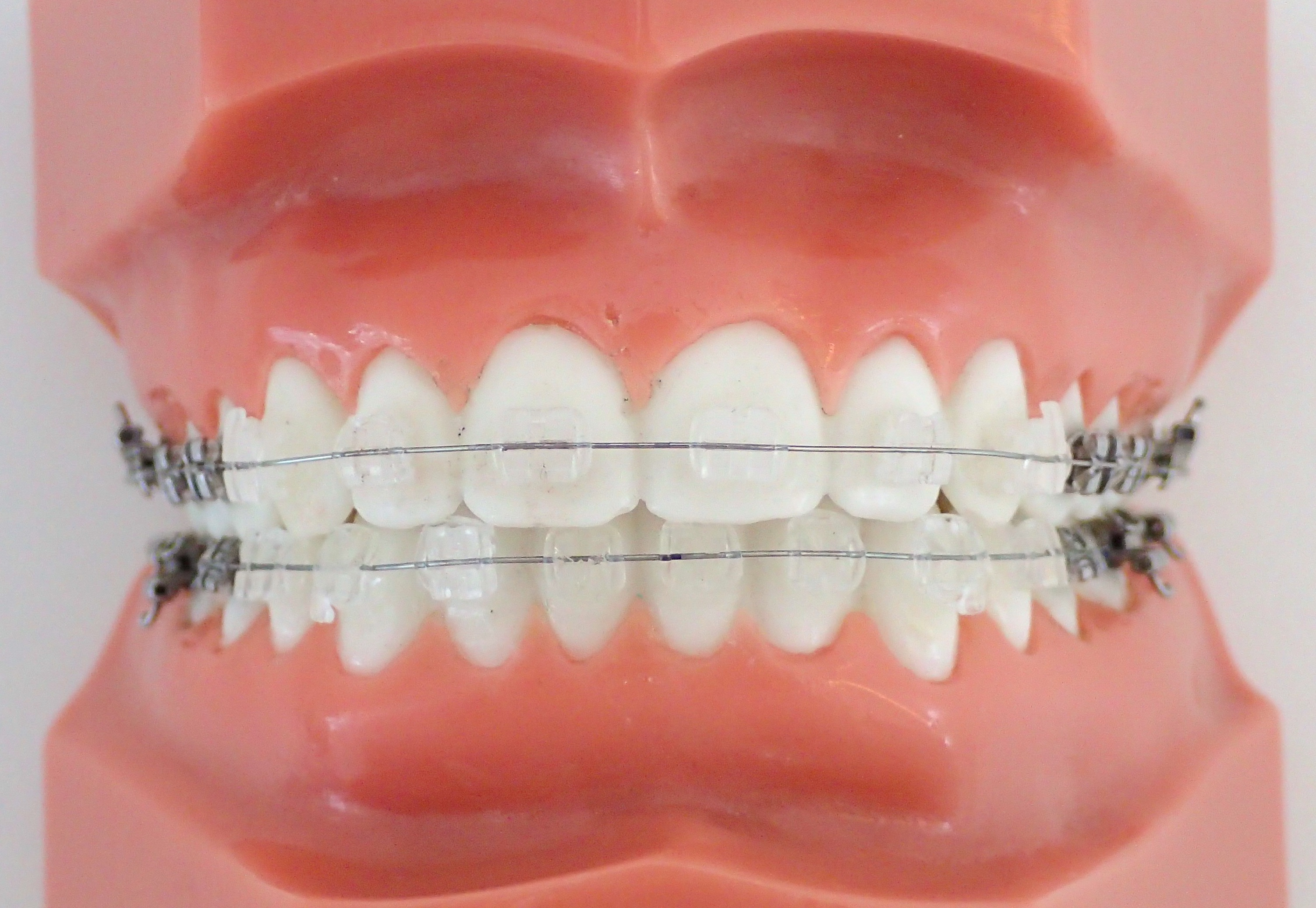 メタルワイヤー